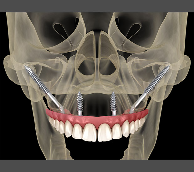 Monroe Oral Surgeon